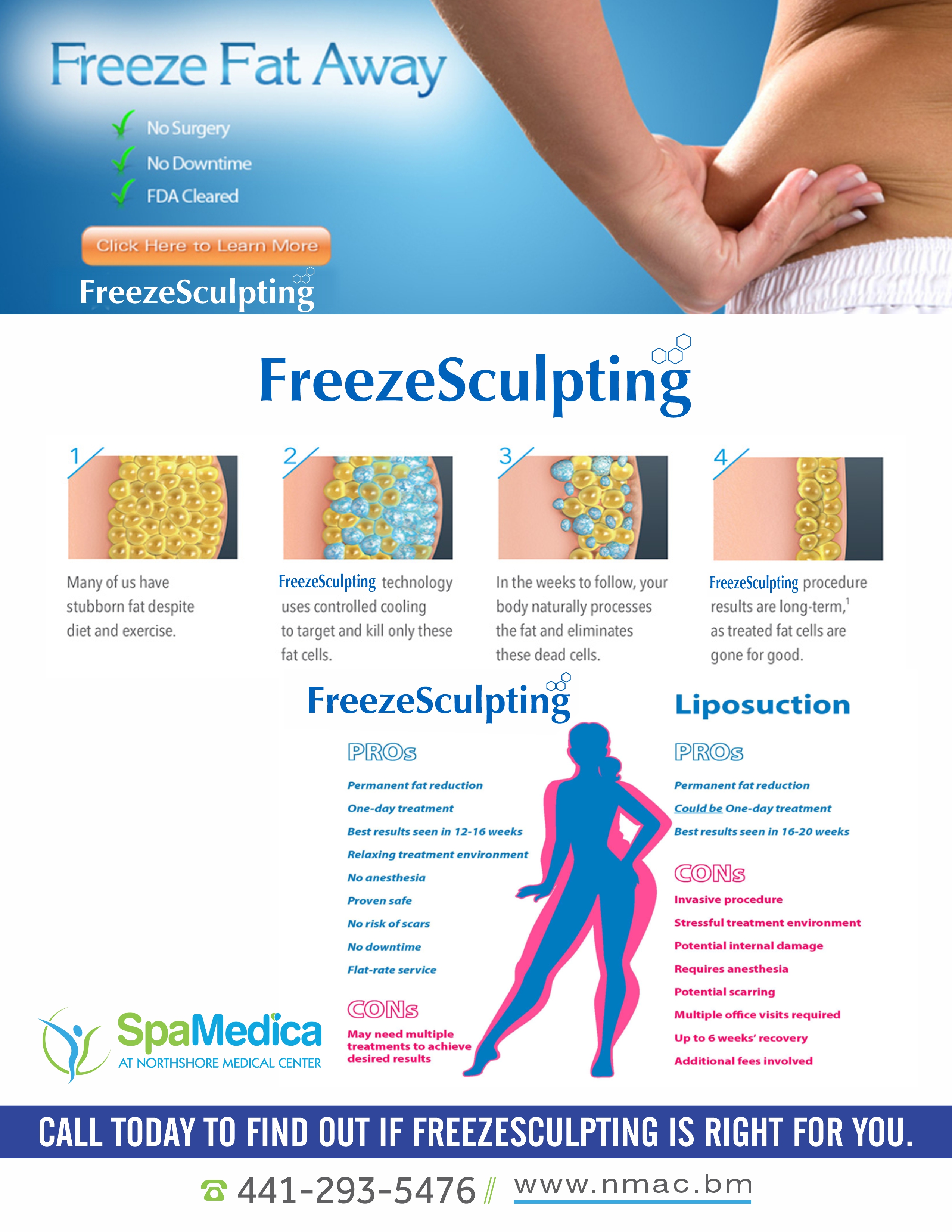 Freezesculpting
