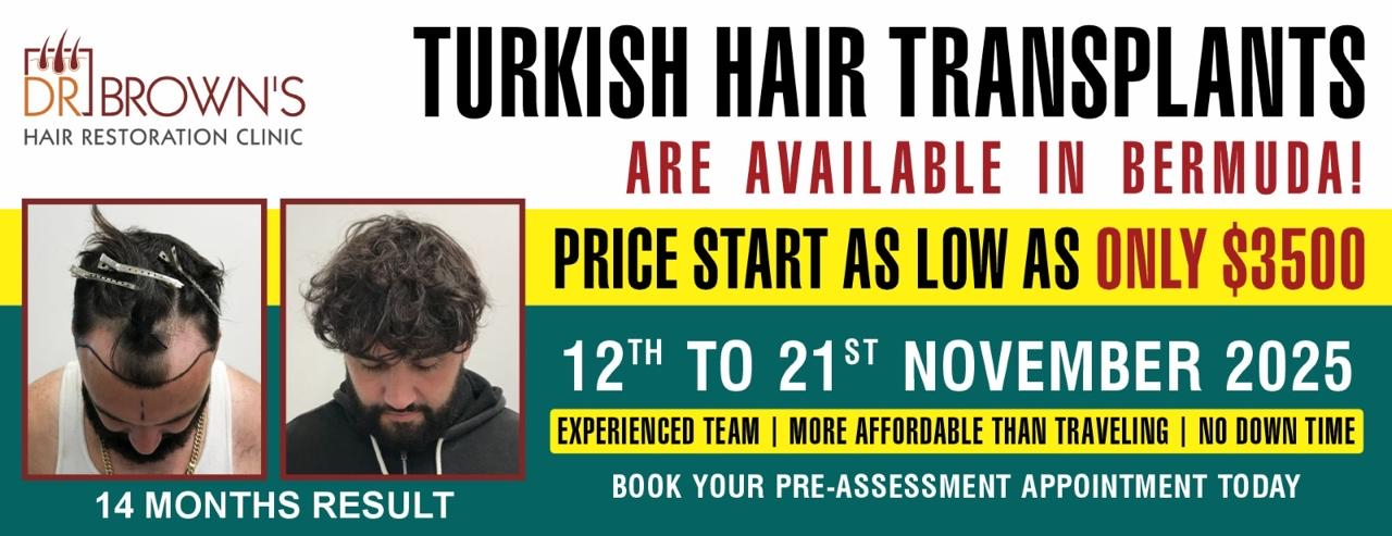 Turkish hair transplant