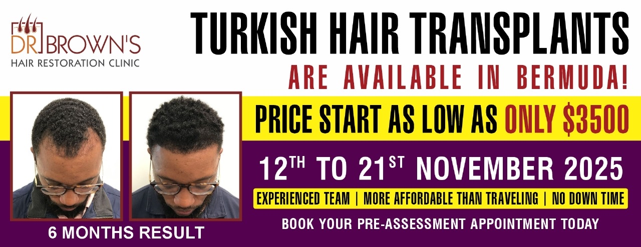 Turkish hair transplant
