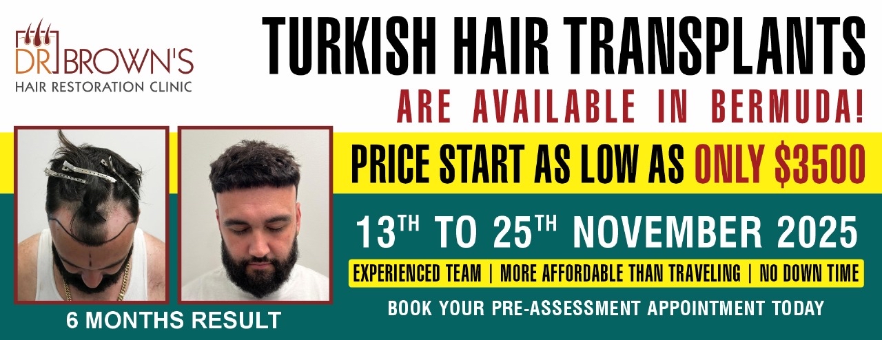 Turkish hair transplant