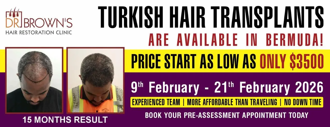 Turkish hair transplant