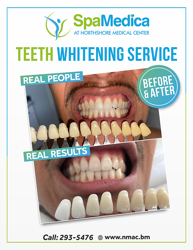 NMAC - Theet Whitening Service